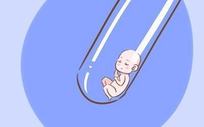 极光生殖